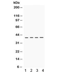 CSNK1A1 Antibody