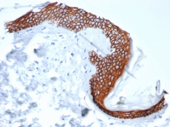 IHC staining of FFPE human tonsil tissue with Syndecan-1 antibody (clone SDC1/7180). HIER: boil tiss