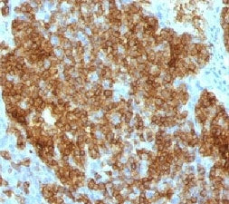 IHC test of FFPE human tonsil probed with anti-CD45RA antibody (clone SPM568).