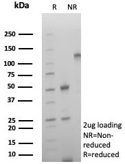 SDS-PAGE analysis of purified, BSA-free CD39 antibody (clone rCD39/8682) as confirmation of integrit