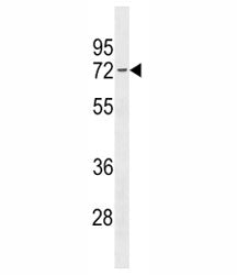 Estrogen Receptor antibody western blot analysis in 293 lysate. Predicted molecular weight: 65-70 kD