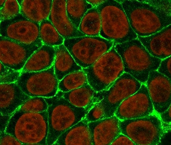 Immunofluorescent staining of human MCF7 cells with EpCAM antibody (clone EPM17-1, green) and Reddot