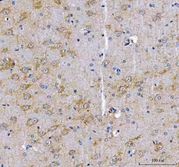 IHC staining of FFPE rat brain tissue with LRRN1 antibody. HIER: boil tissue sections in pH8 EDTA fo