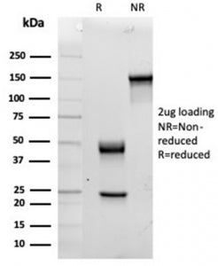 Analysis of HuProt(TM) microarray containing more than 19,000 full-length human proteins using IL15 