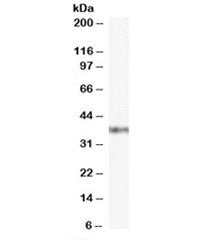 Western blot testing of Jurkat cell lysate with GBX2 antibody at 0.1ug/ml. Predicted molecular weigh