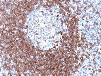 IHC testing of FFPE human tonsil with CD79a antibody. Required HIER: boil tissue sections in pH 9 10