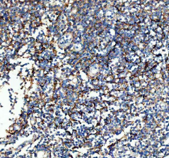 Western blot testing of 1ng of human recombinant protein with VCAM1 antibody at 0.5ug/ml. Expected m