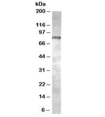 Western blot testing of Jurkat lysate with ACAP1 antibody at 0.5ug/ml. Predicted molecular weight: ~