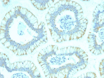 SMAD4 Antibody