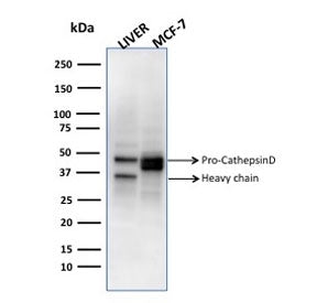 CTSD Antibody / Cathepsin D
