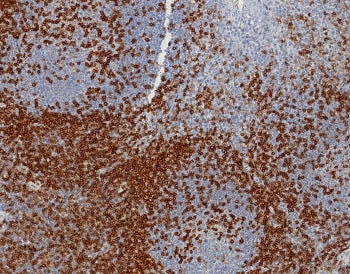 IHC staining of FFPE human tonsil tissue with CD45RA antibody (clone PTPRC/8124R). HIER: boil tissue