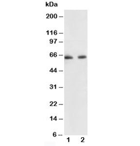 Western blot testing of p65 antibody and Lane 1: human colon cancer; 2: HeLa lysate. Expected molecu