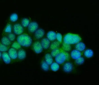 Immunofluorescent staining of FFPE human RT4 cells with PSEN1 antibody (green) and DAPI nuclear stai