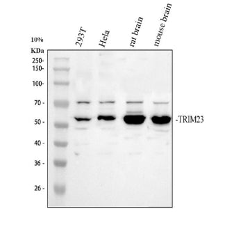 Western blot analysis of TRIM23 using anti-TRIM23 antibody. Electrophoresis was performed on a 10% S