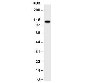 Western blot testing of CSF1R antibody and rat intestine tissue lysate. Predicted molecular weight ~110 kDa.