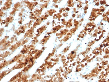 IHC staining of FFPE human adrenal gland tissue with Interleukin-18 receptor accessory protein antib