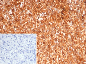 IHC staining of FFPE human spleen tissue with Calprotectin antibody (clone S100A9/7551). Inset: PBS 