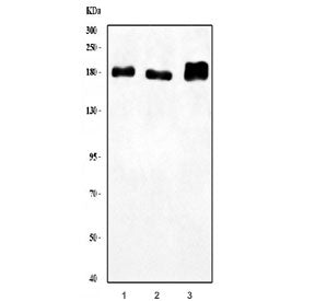 Western blot testing of 1) human HEL, 2) human K562 and 3) rat brain lysate with LARG antibody. Pred