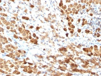 S100B Antibody