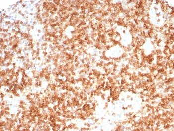 IHC staining of FFPE human lymph node tissue with CD3G / CD3beta1 antibody (clone CD3G/8794). HIER: 