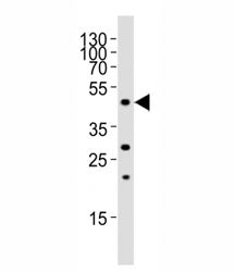 FOXA2 Antibody