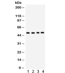 Western blot testing of human 1) MCF7, 2) SW620, 3) HeLa and 4) SKOV cell lysate with SOCS4 antibody
