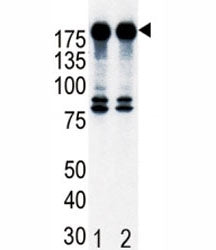 Western blot analysis of ErbB2 in T47D cell lysate, either noninduced (Lane 1) or induced with HRG (