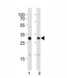 Western blot analysis of lysate from (1) A431 and (2) SK-BR-3 cell line using CDK1 antibody at 1:100