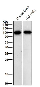 All lanes use the Phospho-Beta Catenin (Thr41/Ser45) antibody at 1:1K dilution for 1 hour at room te