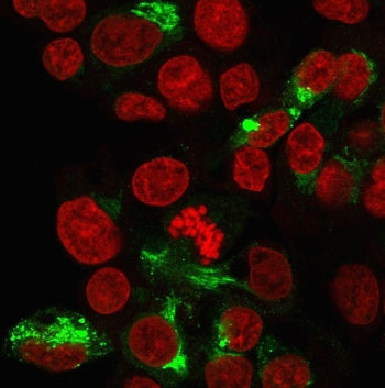 Immunofluorescent staining of paraformaldehyde-fixed human HepG2 cells with Albumin antibody (green,