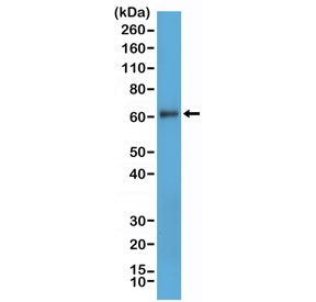 Western blot testing of human MDA-MB-231 cell lysate with recombinant CD73 antibody at 1:1000. Predi