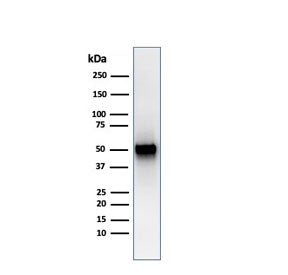 Western blot testing of human spleen lysate with recombinant PD-ECGF antibody (clone rTYMP/3444). Pr