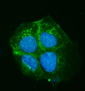 Immunofluorescent staining of FFPE human Caco-2 cells with ATP7B antibody (green) and DAPI nuclear s