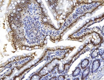 IHC staining of FFPE rat colon tissue with HNF4A antibody. HIER: boil tissue sections in pH8 EDTA fo