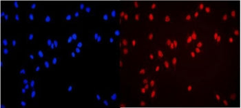 Immunofluorescent staining of FFPE human U-2 OS cells with MCM3 antibody (red) and DAPI nuclear stai