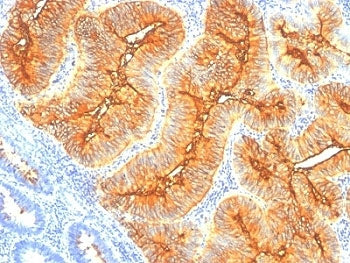 TAG-72 Antibody