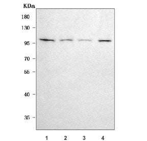 Western blot testing of human 1) HeLa, 2) A549, 3) COLO-320 and 4) A431 cell lysate with CD106 antib