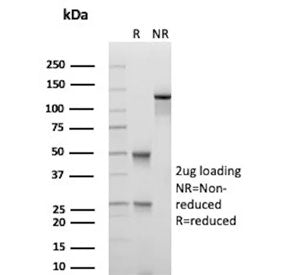 SDS-PAGE analysis of purified, BSA-free DNA-RNA Hybrid antibody (clone S9.6) as confirmation of inte