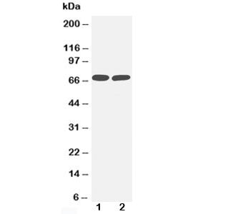 Western blot testing of TNFR2 antibody and Lane 1: MM453; 2: Jurkat cell lysate. Predicted molecular