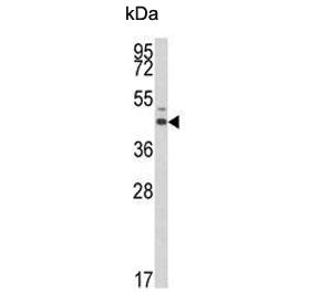 Western blot testing of human A375 cell lysate with Estrogen-Related Receptor Alpha antibody. Expect