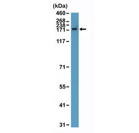 Western blot testing of human T-cell lysate with recombinant CPS1 antibody at 1:10,000 dilution. Pre