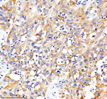 Immunohistochemical staining of CARD10 using anti-CARD10 antibody. CARD10 was detected in a paraffin