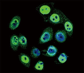 Confocal immunofluorescent analysis of phospho-SMAD4 antibody with HeLa cells followed by Alexa Fluo