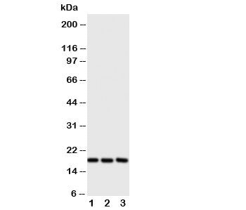 Western blot testing of I-309 antibody and Lane 1: SCG; 2: COLO320; 3: Jurkat cell lysate. Expeced s