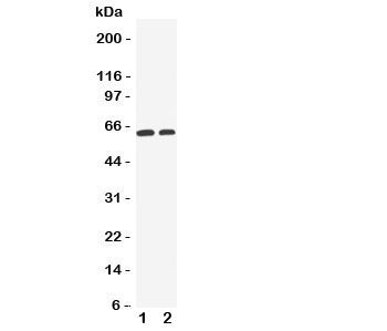 Western blot testing of OCT1 antibody and Lane 1: human HeLa cell lysate; 2: human A549 cell lysate.