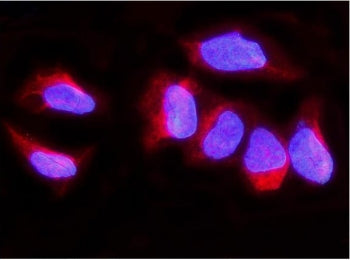 Immunofluorescent staining of FFPE human U-2 OS cells with SYNPO antibody (red) and DAPI nuclear sta