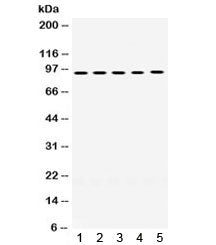 Western blot testing of human 1) A549, 2) SW620, 3) HeLa, 4) PANC, and 5) HepG2 lysate with MCM8 ant