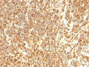 CD20 Antibody