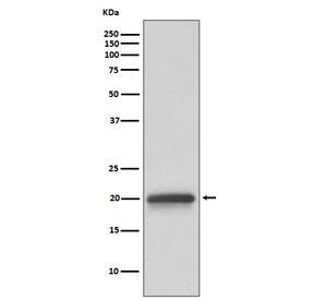 Western blot testing of human fetal brain lysate with Claudin 5 antibody. Predicted molecular weight