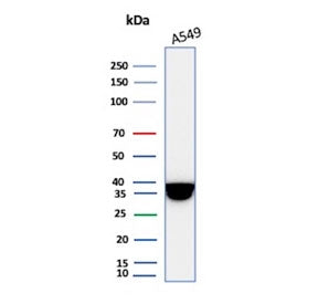 Western blot testing of human A549 cell lysate with recombinant Annexin A1 antibody. Predicted molec
